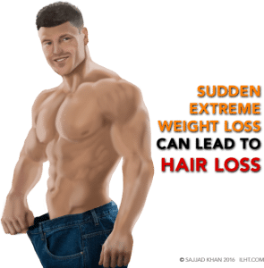 extreme-weight-loss