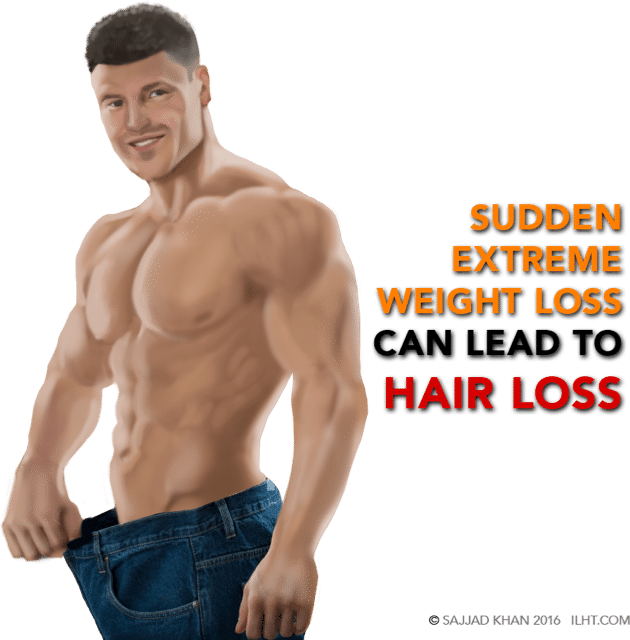 Diagnosis of Hair Loss in Men - ILHT Dubai