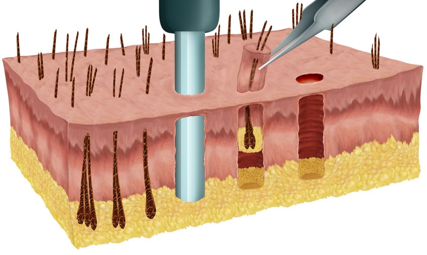 fue_cross-section-flat